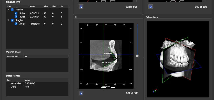 Volumeviewer für CT-Datensätze